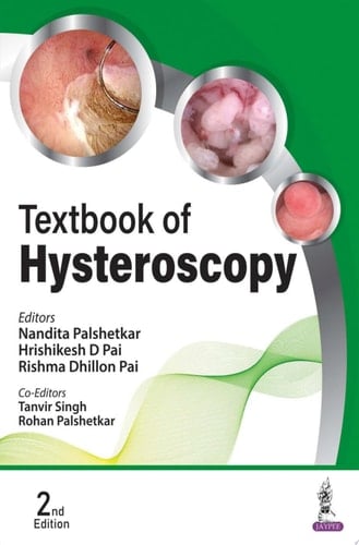Textbook of Hysteroscopy
