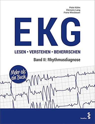 EKG Rhythmusdiagnose