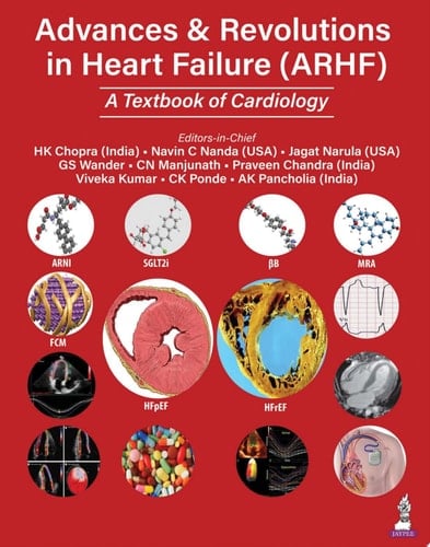 Advances & Revolutions in Heart Failure (ARHF) A Textbook of Cardiology