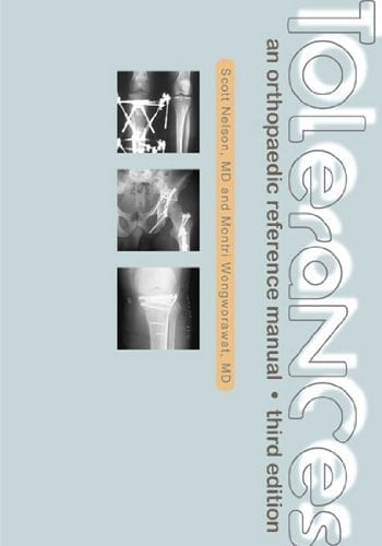 Tolerances An Orthopaedic Reference Manual