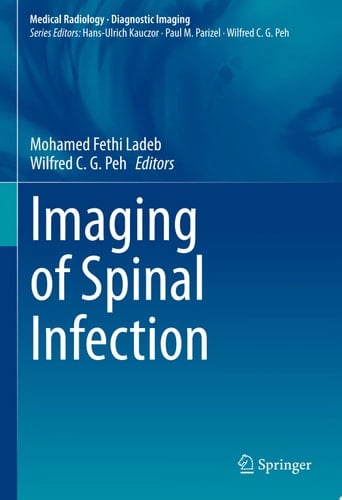 Imaging of Spinal Infection