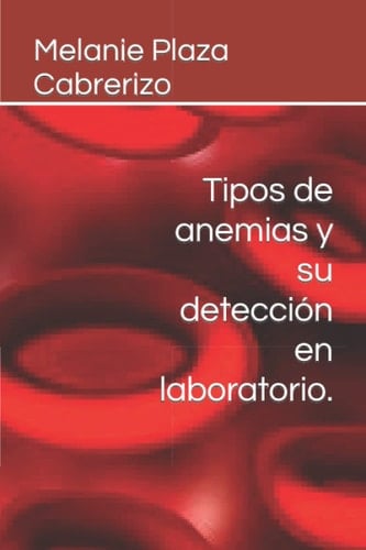 Tipos de anemias y su detección en laboratorio. (Spanish Edition)