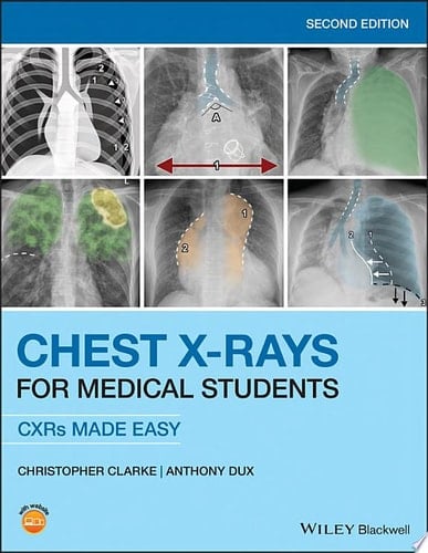 Chest X-Rays for Medical Students CXRs Made Easy