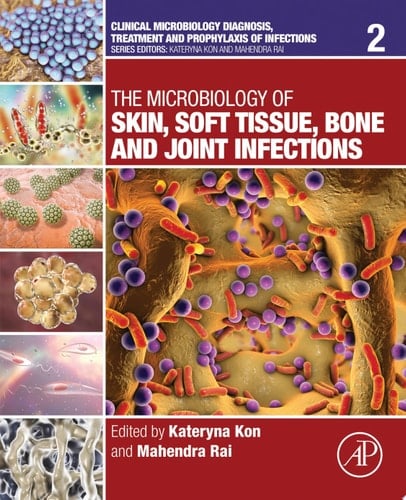 The Microbiology of Skin, Soft Tissue, Bone and Joint Infections