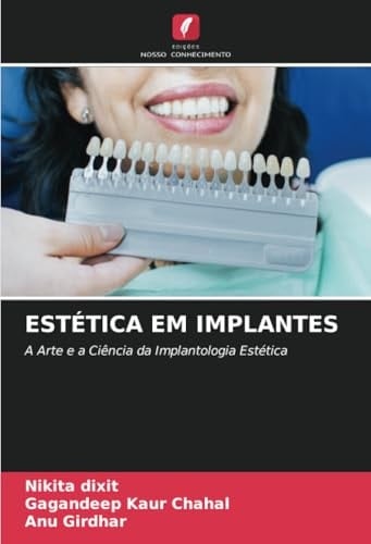 ESTÉTICA EM IMPLANTES: A Arte e a Ciência da Implantologia Estética (Portuguese Edition)