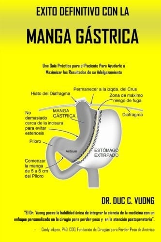 Exito Definitivo con la Manga Gástrica Una Guía Práctica para el Paciente para Ayudarle a Maximizar Su Adelgazamiento