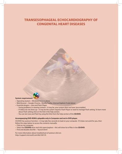 Transesophageal Echocardiography of Congenital Heart Diseases