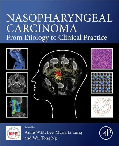 Nasopharyngeal Carcinoma From Etiology to Clinical Practice