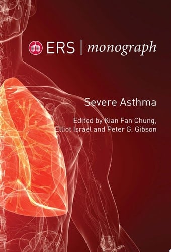 Severe Asthma