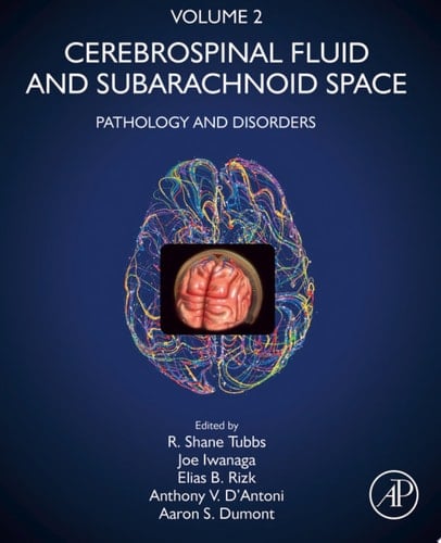 Cerebrospinal Fluid and Subarachnoid Space