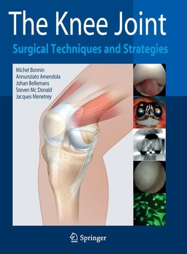 The Knee Joint Surgical Techniques and Strategies