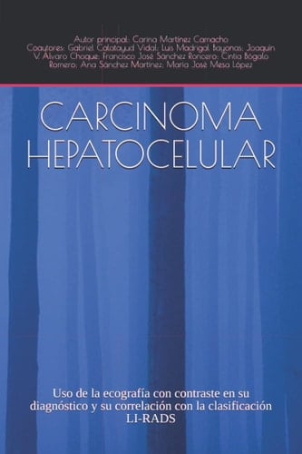 CARCINOMA HEPATOCELULAR: Uso de la ecografía con contraste en su diagnóstico y su correlación con la clasificación LI-RADS (Spanish Edition)