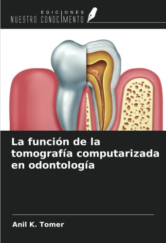 La función de la tomografía computarizada en odontología (Spanish Edition)