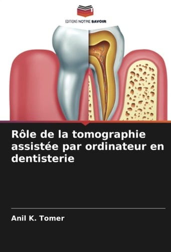 Rôle de la tomographie assistée par ordinateur en dentisterie (French Edition)