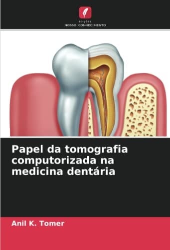 Papel da tomografia computorizada na medicina dentária (Portuguese Edition)