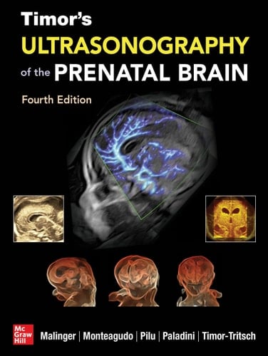 Timor's Ultrasonography of the Prenatal Brain