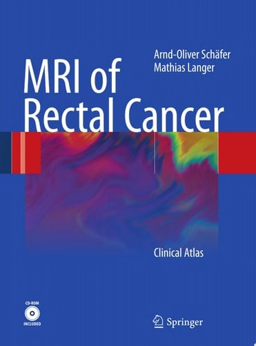 MRI of Rectal Cancer