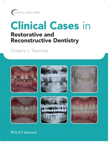 Clinical Cases in Restorative and Reconstructive Dentistry