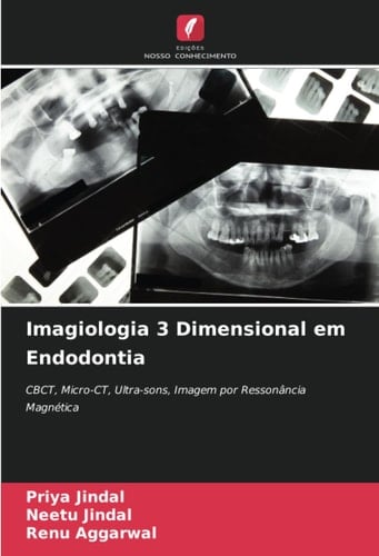 Imagiologia 3 Dimensional em Endodontia: CBCT, Micro-CT, Ultra-sons, Imagem por Ressonância Magnética (Portuguese Edition)