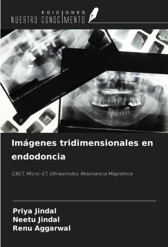 Imágenes tridimensionales en endodoncia: CBCT, Micro-CT, Ultrasonidos, Resonancia Magnética (Spanish Edition)