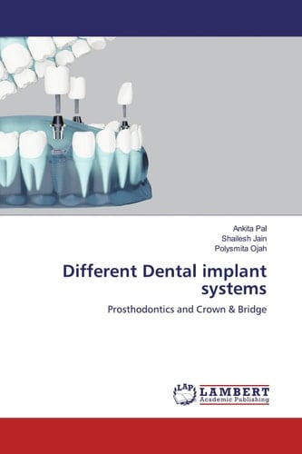 Different Dental implant systems