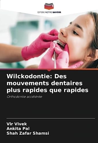 Wilckodontie: Des mouvements dentaires plus rapides que rapides: Orthodontie accélérée (French Edition)