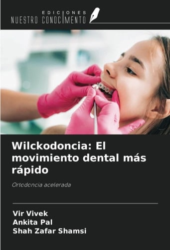 Wilckodoncia: El movimiento dental más rápido: Ortodoncia acelerada (Spanish Edition)
