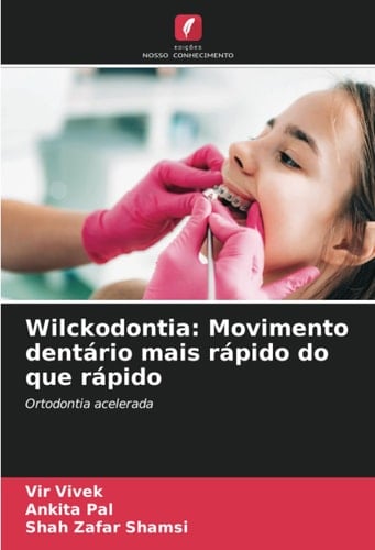Wilckodontia: Movimento dentário mais rápido do que rápido: Ortodontia acelerada (Portuguese Edition)