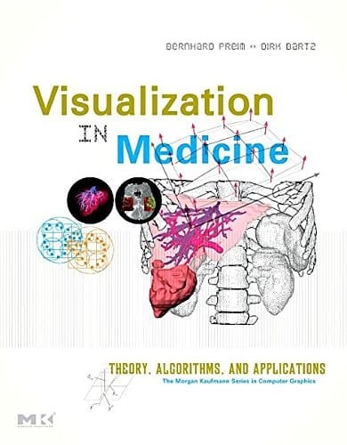 Visual Computing for Medicine Theory, Algorithms, and Applications