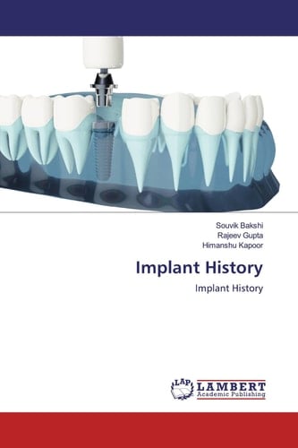 Implant History: Implant History