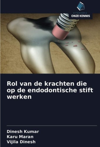 Rol van de krachten die op de endodontische stift werken (Dutch Edition)