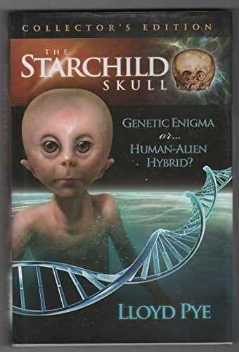 The Starchild Skull Genetic Enigma Or--human Alien Hybrid?
