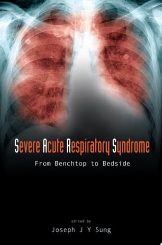 Severe Acute Respiratory Syndrome From Benchtop to Bedside