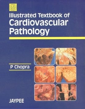 Illustrated Textbook of Cardiovascular Pathology