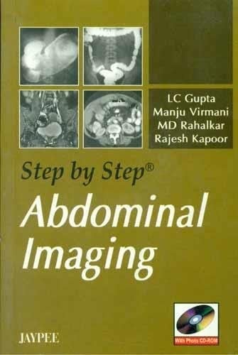 Step by Step Abdominal Imaging