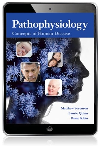 Pathophysiology: Concepts of Human Disease (Pearson+)