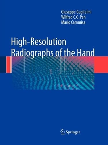 High-Resolution Radiographs of the Hand