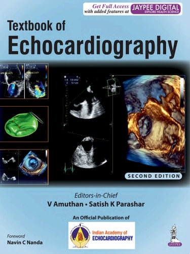 Textbook of Echocardiography