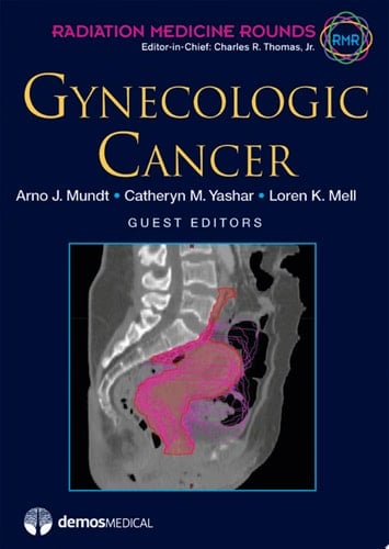 Gynecologic Cancer
