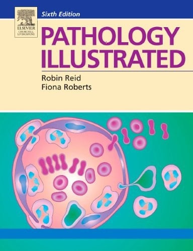 Pathology Illustrated