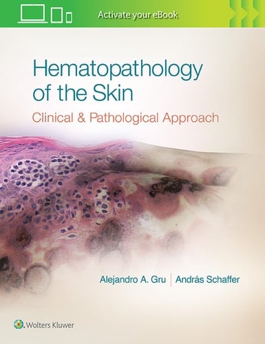 Hematopathology of the Skin Clinical and Pathological Approach