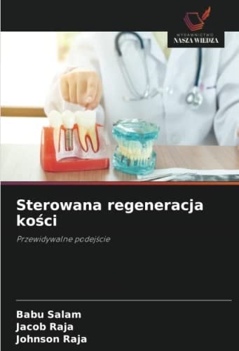 Sterowana regeneracja kości: Przewidywalne podejście (Polish Edition)