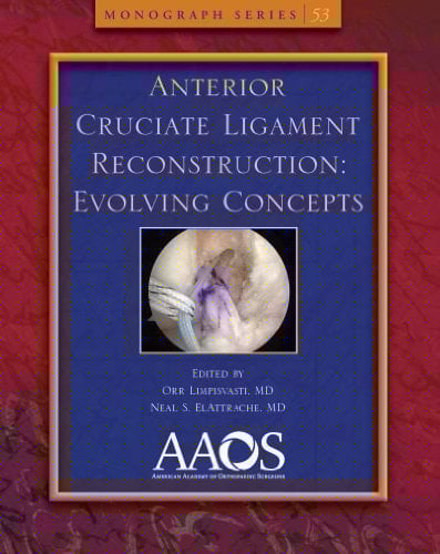 Anterior Cruciate Ligament Reconstruction Evolving Concepts
