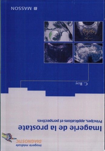 Imagerie de la prostate