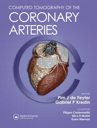 Computed Tomography of the Coronary Arteries
