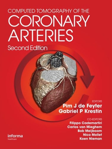 Computed Tomography of the Coronary Arteries, Second Edition
