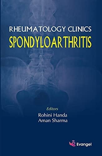 Spondyloarthritis