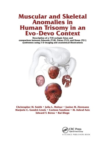 Muscular and Skeletal Anomalies in Human Trisomy in an Evo-Devo Context Description of a T18 Cyclopic Fetus and Comparison Between Edwards (T18), Patau (T13) and Down (T21) Syndromes Using 3-D Imaging and Anatomical Illustrations