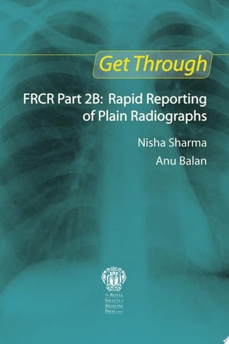 Get Through FRCR Part 2B: Rapid Reporting of Plain Radiographs