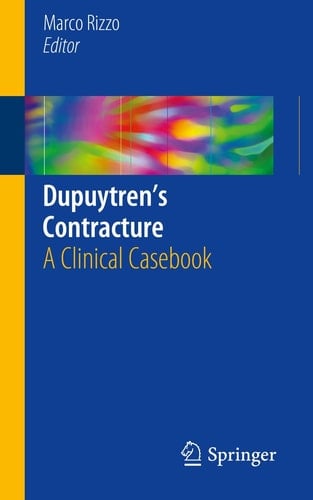 Dupuytren’s Contracture A Clinical Casebook